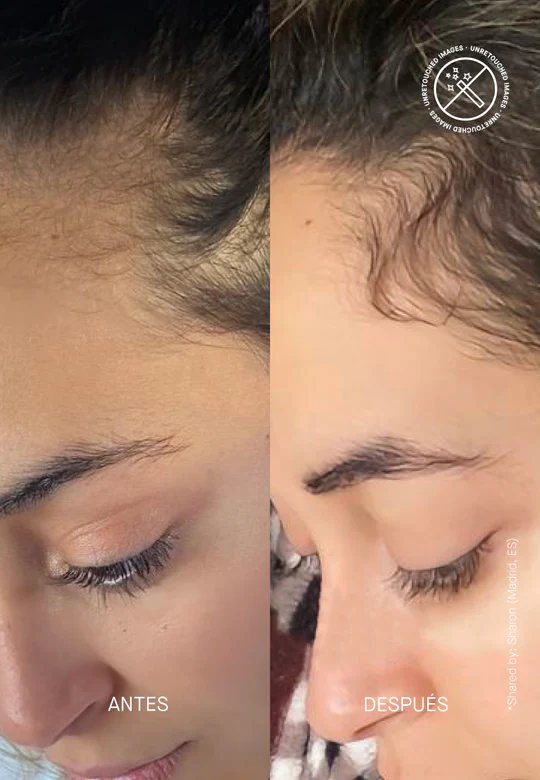 Transparent Lab Hair Density Scalp Treatment 50ml - Imagen 4