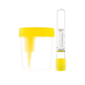 Kit de Muestra de Orina con Tubo de Vacío Aposan