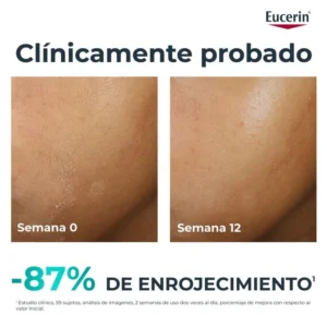 Alternative view of Eucerin DermoPure Clinical Hydra Repair 40 mL